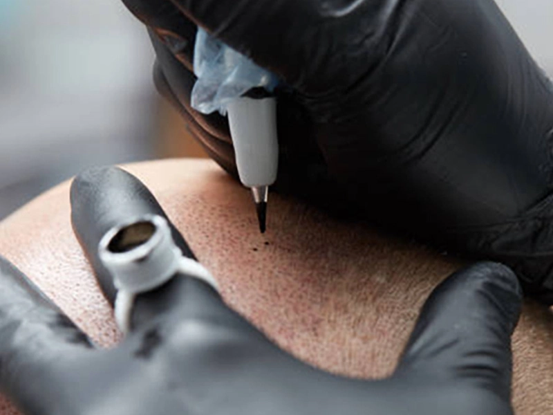 Tattoo artist using a tattoo machine on scalp