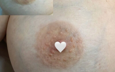 Areola Pigmentation Guide: Nipple Tattoo 101
